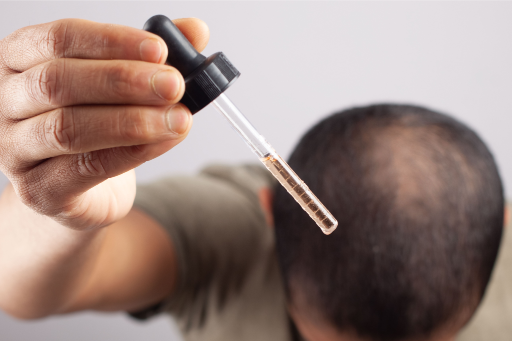 Tratamento da calvície: como aumentar os resultados com uma rotina de cuidado capilar? – Minoxidil